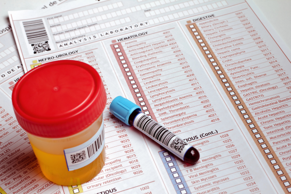 Same-Day Drug Testing for Employers and Job Applicants