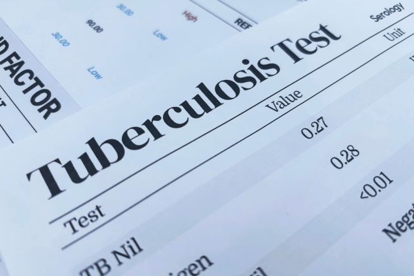 Why TB Testing Remains Important for Healthcare and School Employees